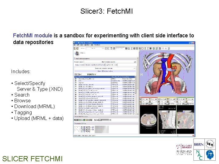 Slicer 3: Fetch. MI module is a sandbox for experimenting with client side interface