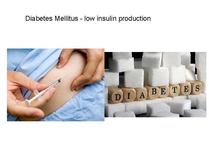 Diabetes Mellitus - low insulin production 