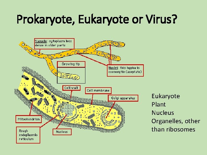 Prokaryote, Eukaryote or Virus? Eukaryote Plant Nucleus Organelles, other than ribosomes Prokaryote, Eukaryote or Virus? Eukaryote Plant Nucleus Organelles, other than ribosomes