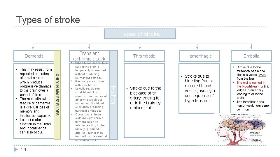 Types of stroke Transient ischemic attack Dementia Extra 24 ONLY IN MALES’ SLIDES •