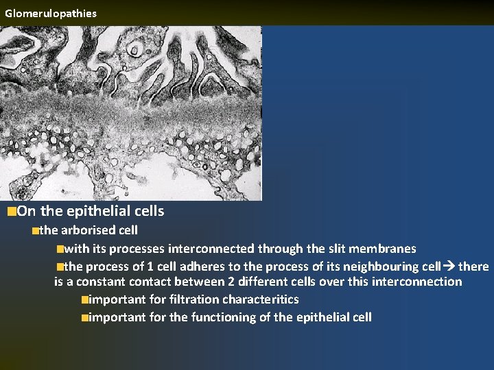 Glomerulopathies On the epithelial cells the arborised cell with its processes interconnected through the