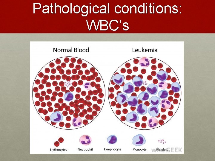 Pathological conditions: WBC’s Pathological conditions: WBC’s
