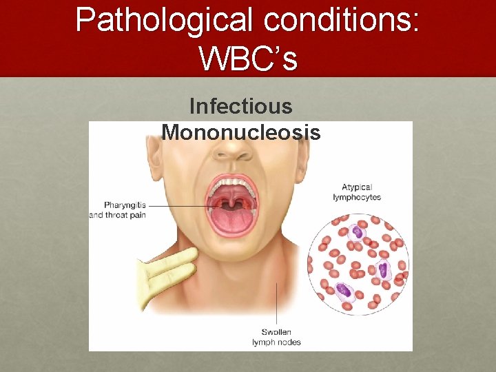 Pathological conditions: WBC’s Infectious Mononucleosis Pathological conditions: WBC’s Infectious Mononucleosis