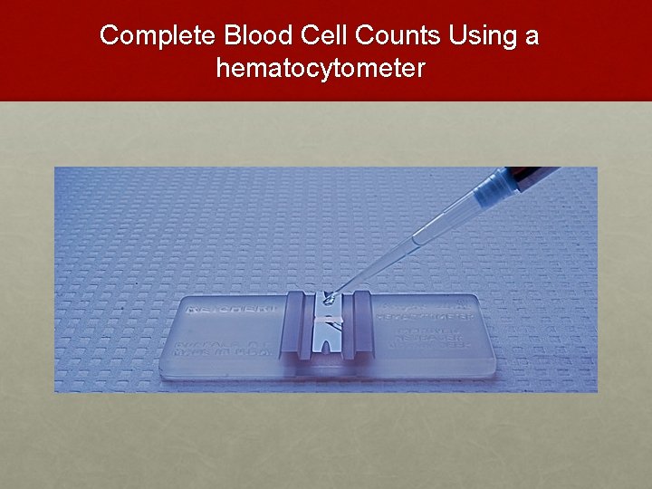 Complete Blood Cell Counts Using a hematocytometer Complete Blood Cell Counts Using a hematocytometer