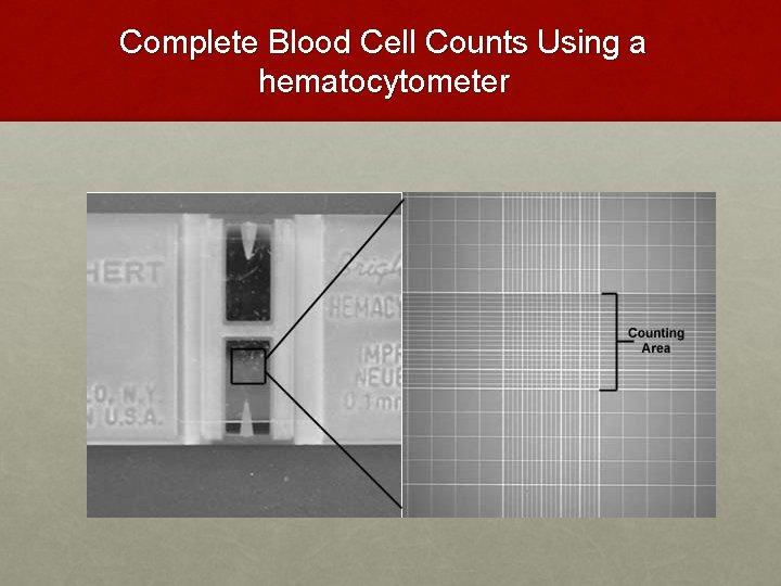 Complete Blood Cell Counts Using a hematocytometer Complete Blood Cell Counts Using a hematocytometer