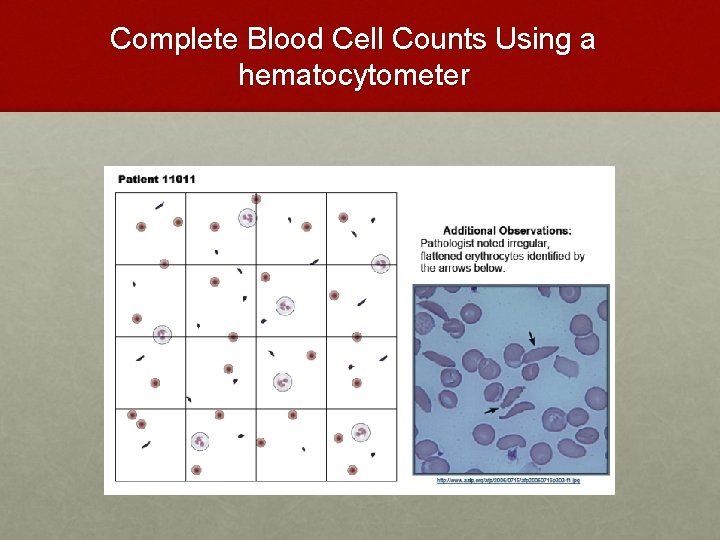 Complete Blood Cell Counts Using a hematocytometer Complete Blood Cell Counts Using a hematocytometer