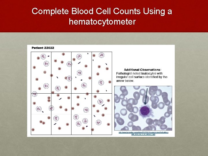 Complete Blood Cell Counts Using a hematocytometer Complete Blood Cell Counts Using a hematocytometer