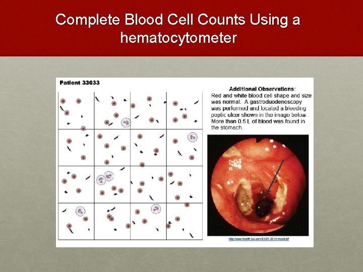 Complete Blood Cell Counts Using a hematocytometer Complete Blood Cell Counts Using a hematocytometer