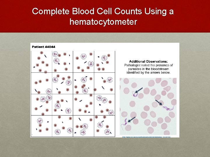 Complete Blood Cell Counts Using a hematocytometer Complete Blood Cell Counts Using a hematocytometer