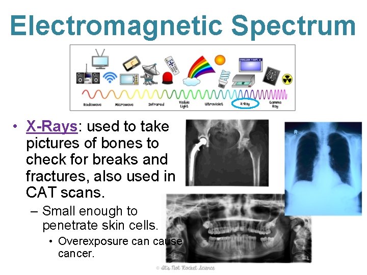 Electromagnetic Spectrum • X-Rays: used to take pictures of bones to check for breaks