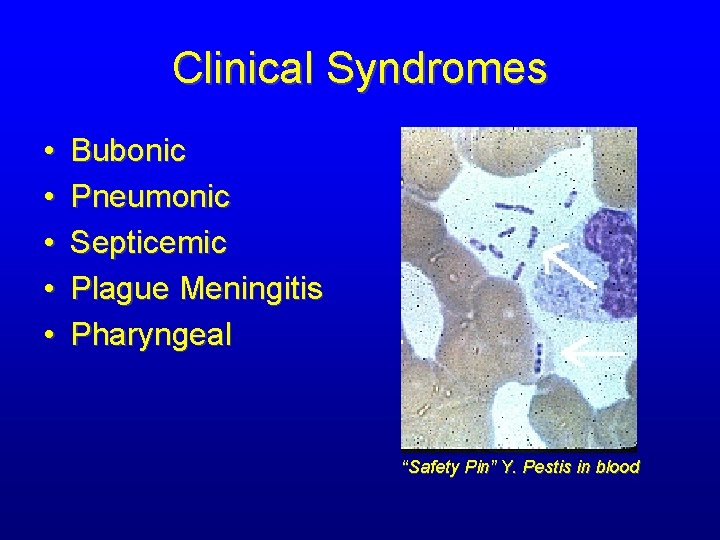 Clinical Syndromes • • • Bubonic Pneumonic Septicemic Plague Meningitis Pharyngeal “Safety Pin” Y.