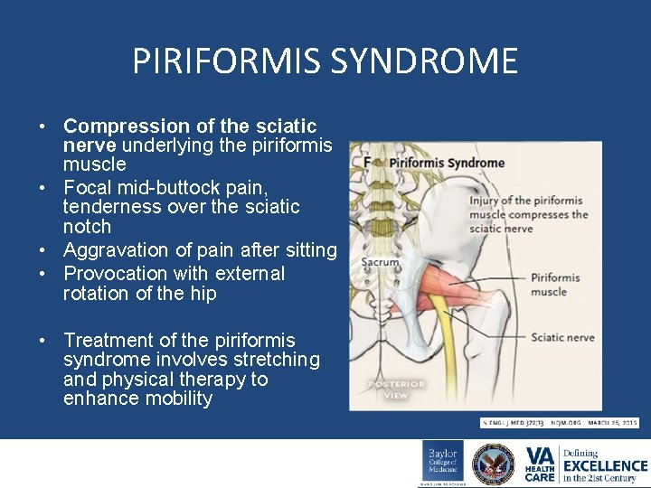 PIRIFORMIS SYNDROME • Compression of the sciatic nerve underlying the piriformis muscle • Focal