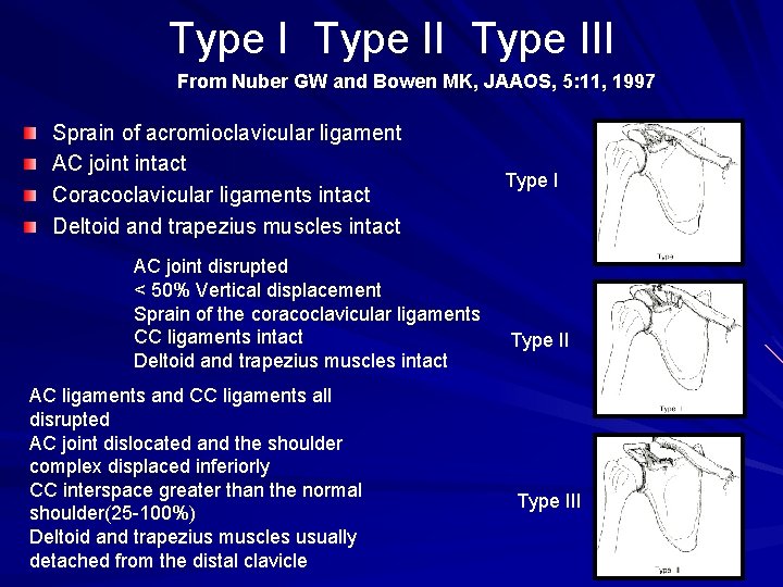 Type III From Nuber GW and Bowen MK, JAAOS, 5: 11, 1997 Sprain of