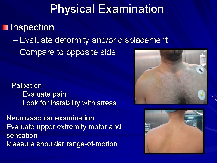 Physical Examination Inspection – Evaluate deformity and/or displacement – Compare to opposite side. Palpation