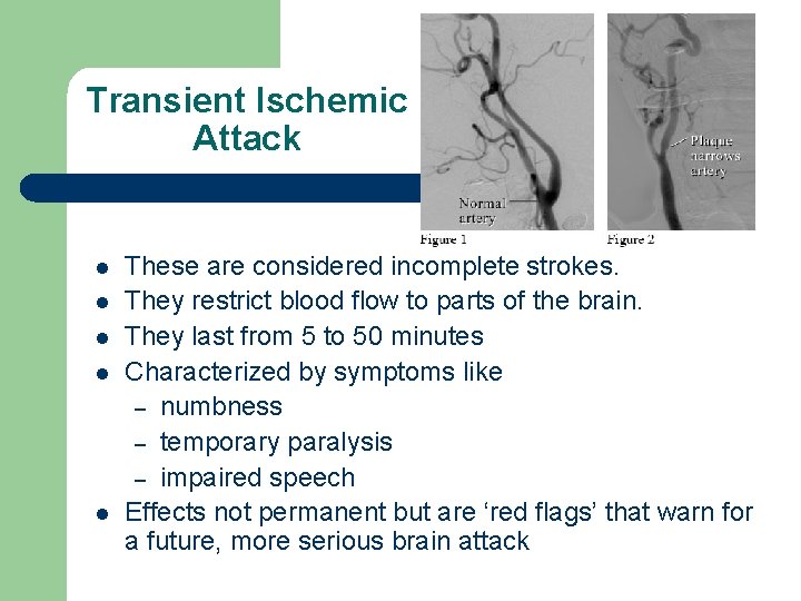 Transient Ischemic Attack l l l These are considered incomplete strokes. They restrict blood