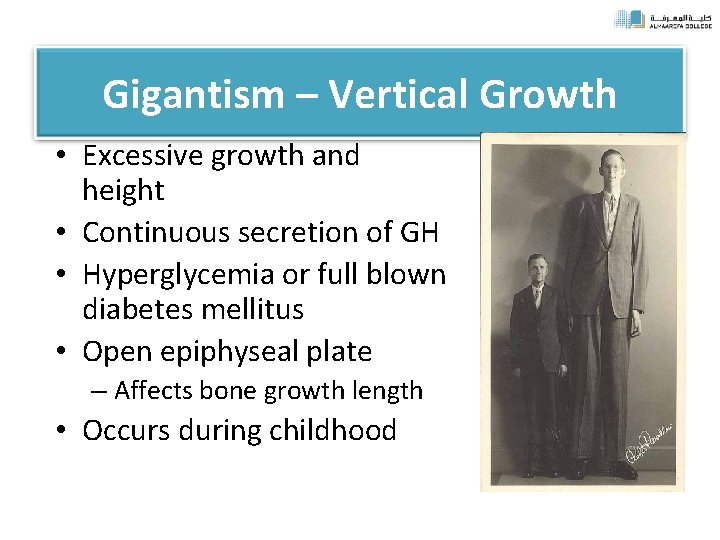 Gigantism – Vertical Growth • Excessive growth and height • Continuous secretion of GH