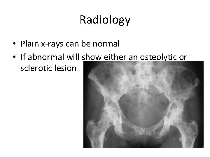 Radiology • Plain x-rays can be normal • If abnormal will show either an