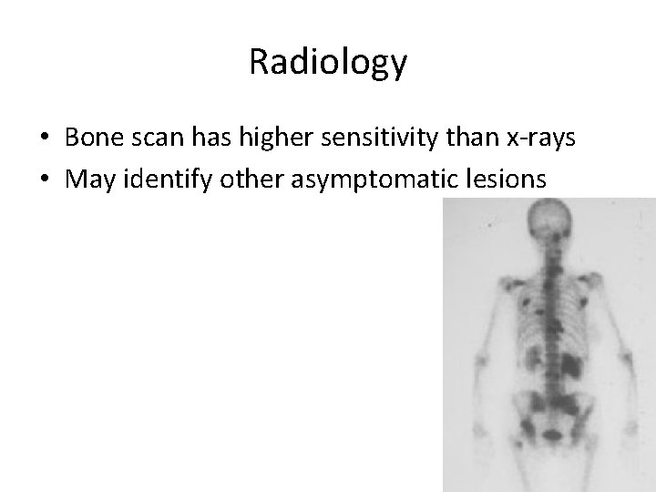 Radiology • Bone scan has higher sensitivity than x-rays • May identify other asymptomatic