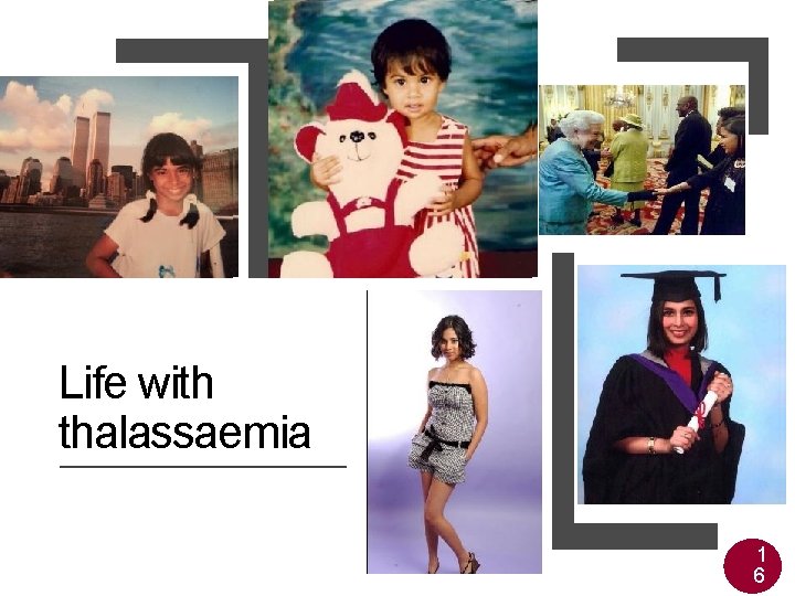 Life with thalassaemia 1 6 