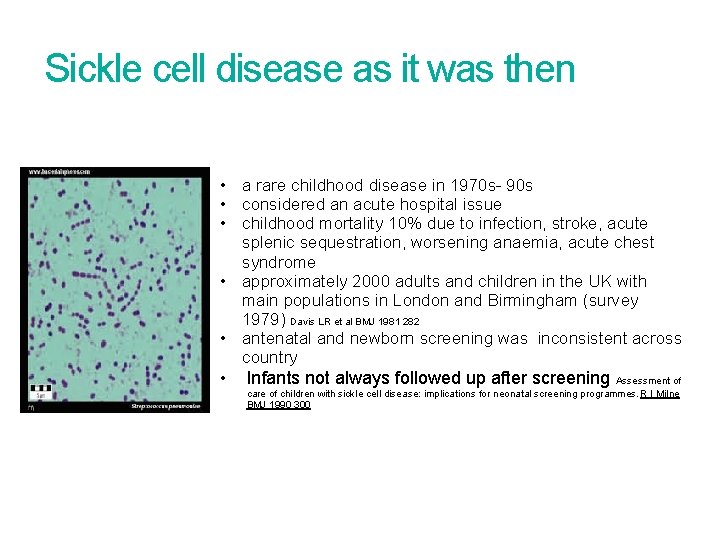 Sickle cell disease as it was then • a rare childhood disease in 1970 Sickle cell disease as it was then • a rare childhood disease in 1970