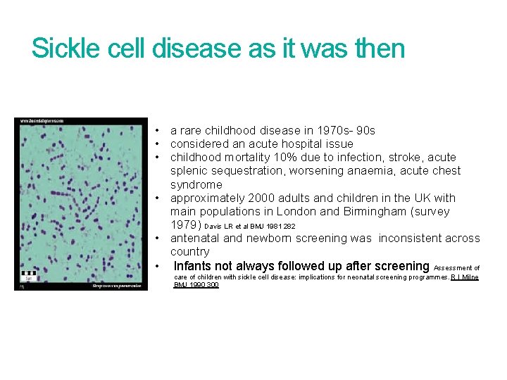 Sickle cell disease as it was then • a rare childhood disease in 1970