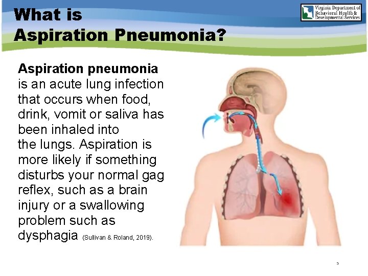 What is Aspiration Pneumonia? Aspiration pneumonia is an acute lung infection that occurs when