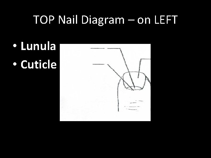 TOP Nail Diagram – on LEFT • Lunula • Cuticle 