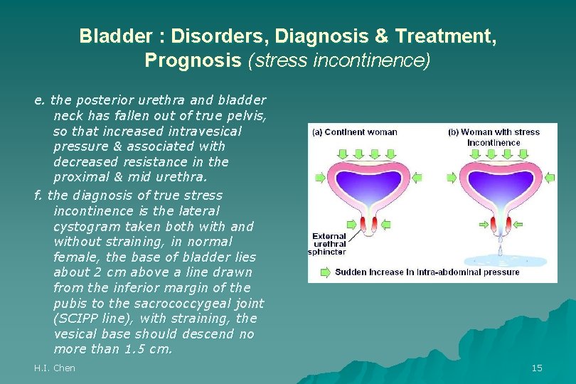 Bladder : Disorders, Diagnosis & Treatment, Prognosis (stress incontinence) e. the posterior urethra and