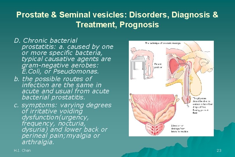 Prostate & Seminal vesicles: Disorders, Diagnosis & Treatment, Prognosis D. Chronic bacterial prostatitis: a.