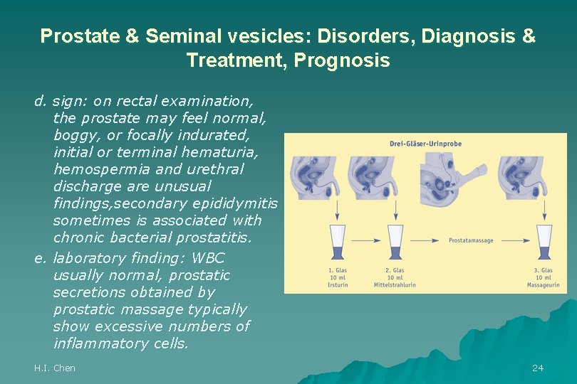 Prostate & Seminal vesicles: Disorders, Diagnosis & Treatment, Prognosis d. sign: on rectal examination,