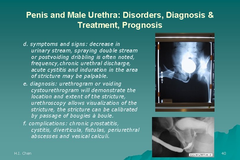 Penis and Male Urethra: Disorders, Diagnosis & Treatment, Prognosis d. symptoms and signs: decrease