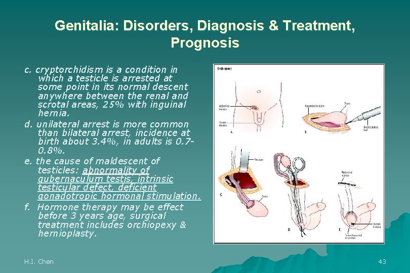 Genitalia: Disorders, Diagnosis & Treatment, Prognosis c. cryptorchidism is a condition in which a