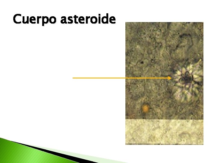 Cuerpo asteroide 