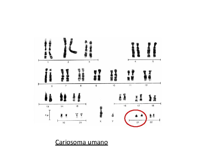Cariosoma umano Cariosoma umano