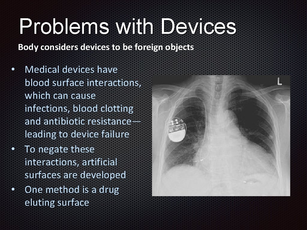 Problems with Devices Body considers devices to be foreign objects • Medical devices have