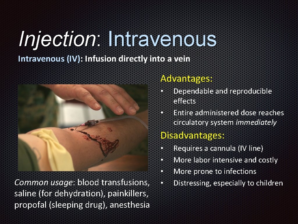 Injection: Intravenous (IV): Infusion directly into a vein Advantages: • • Dependable and reproducible