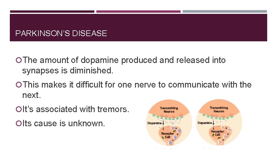 PARKINSON’S DISEASE The amount of dopamine produced and released into synapses is diminished. This