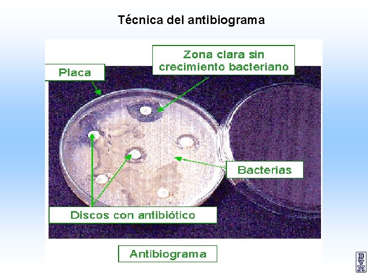 Técnica del antibiograma 33 
