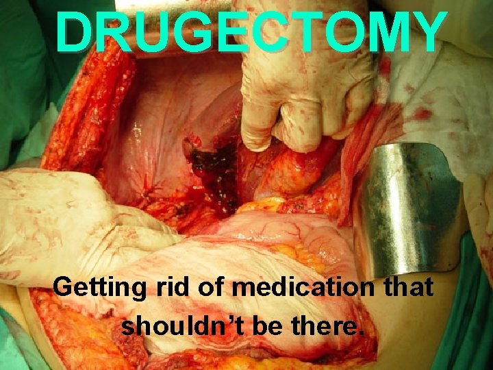 DRUGECTOMY Getting rid of medication that shouldn’t be there. 