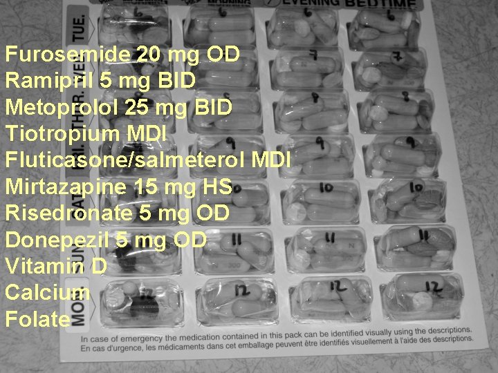Furosemide 20 mg OD Ramipril 5 mg BID Metoprolol 25 mg BID Tiotropium MDI