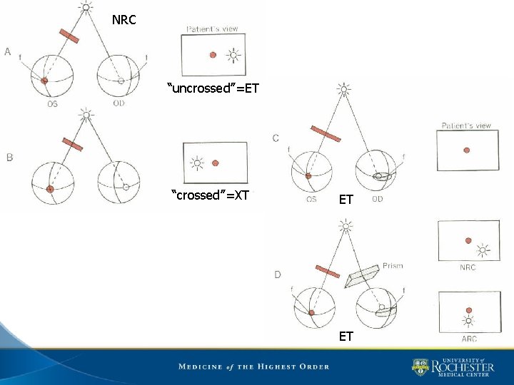 NRC “uncrossed”=ET “crossed”=XT ET ET 