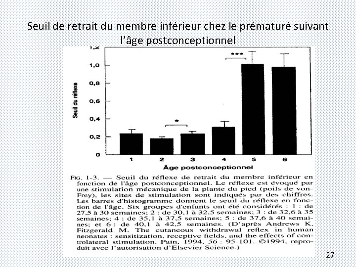Seuil de retrait du membre inférieur chez le prématuré suivant l’âge postconceptionnel 27 