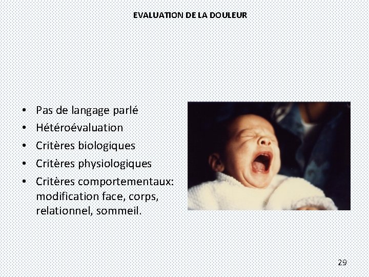 EVALUATION DE LA DOULEUR • • • Pas de langage parlé Hétéroévaluation Critères biologiques