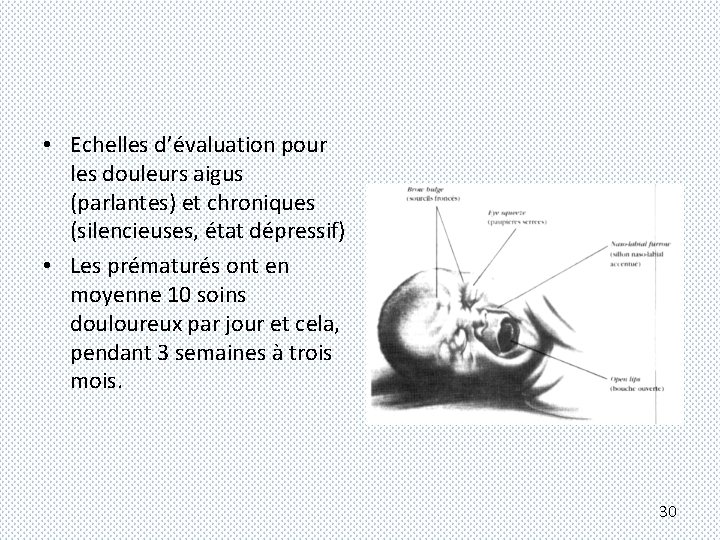  • Echelles d’évaluation pour les douleurs aigus (parlantes) et chroniques (silencieuses, état dépressif)