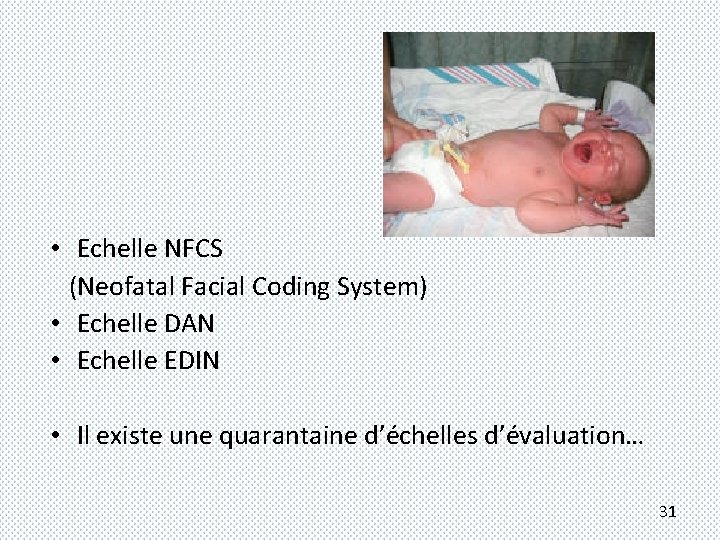  • Echelle NFCS (Neofatal Facial Coding System) • Echelle DAN • Echelle EDIN