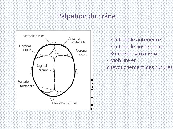 Palpation du crâne - Fontanelle antérieure - Fontanelle postérieure - Bourrelet squameux - Mobilité