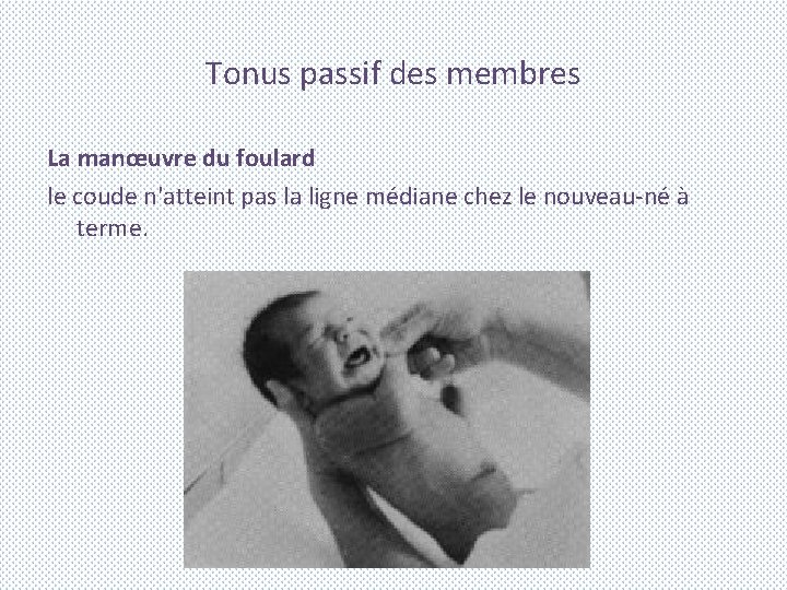 Tonus passif des membres La manœuvre du foulard le coude n'atteint pas la ligne
