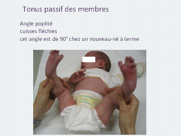 Tonus passif des membres Angle poplité cuisses fléchies cet angle est de 90° chez