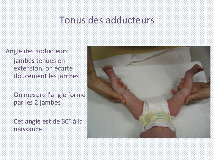 Tonus des adducteurs Angle des adducteurs jambes tenues en extension, on écarte doucement les