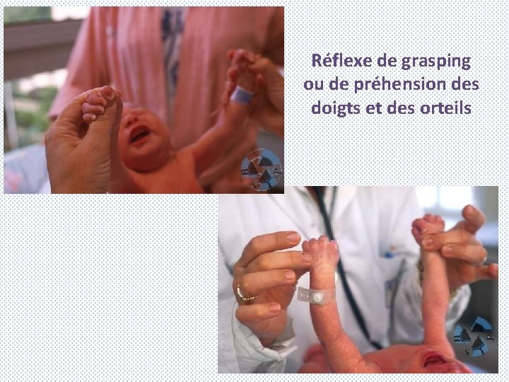 Réflexe de grasping ou de préhension des doigts et des orteils 